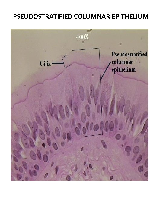 PSEUDOSTRATIFIED COLUMNAR EPITHELIUM PSEUDOSTRATIFIED COLUMNAR EPITHELIUM