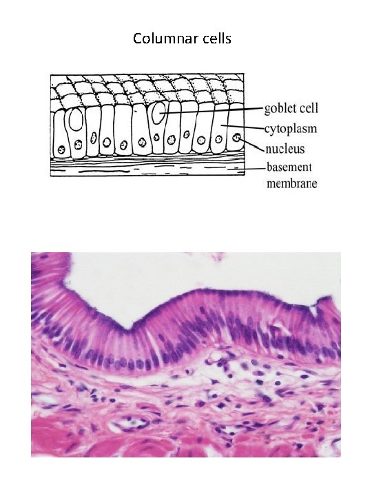 Columnar cells 