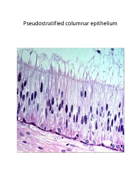 Pseudostratified columnar epithelium Pseudostratified columnar epithelium