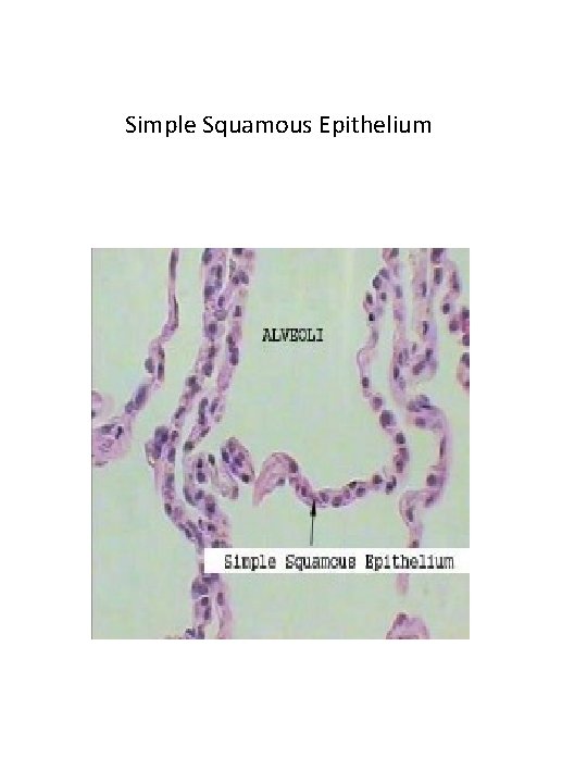 Simple Squamous Epithelium 