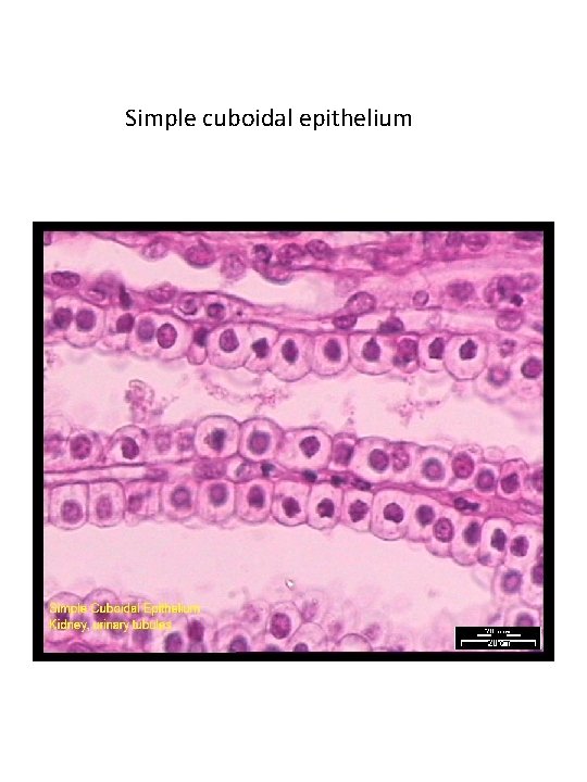 Simple cuboidal epithelium 