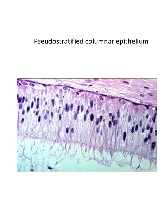 Pseudostratified columnar epithelium Pseudostratified columnar epithelium