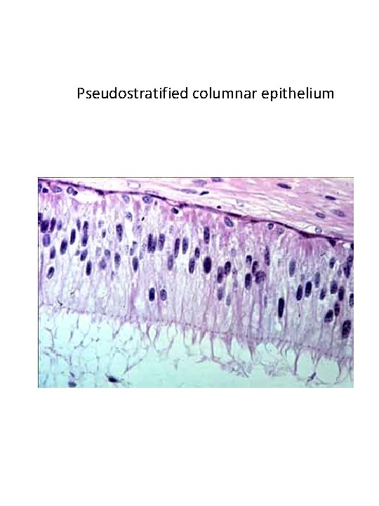 Pseudostratified columnar epithelium 