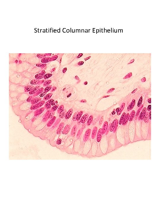 Stratified Columnar Epithelium 