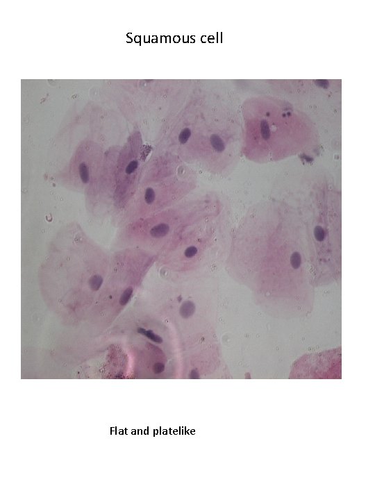 Squamous cell Flat and platelike 