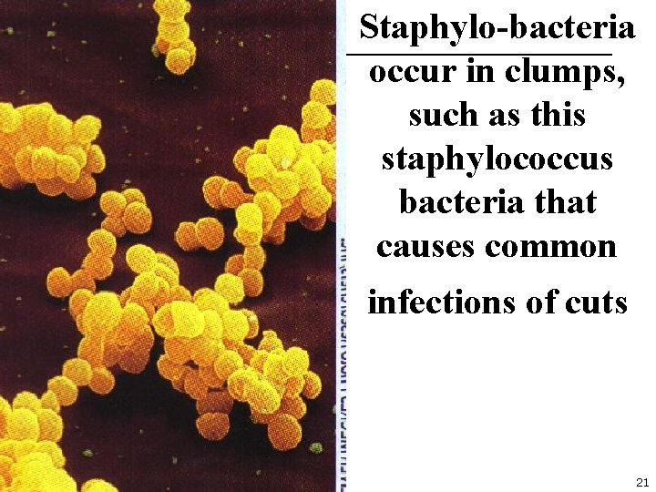 Staphylo-bacteria occur in clumps, such as this staphylococcus bacteria that causes common infections of