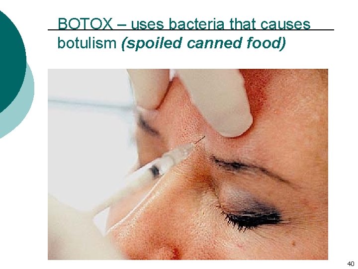 BOTOX – uses bacteria that causes botulism (spoiled canned food) 40 