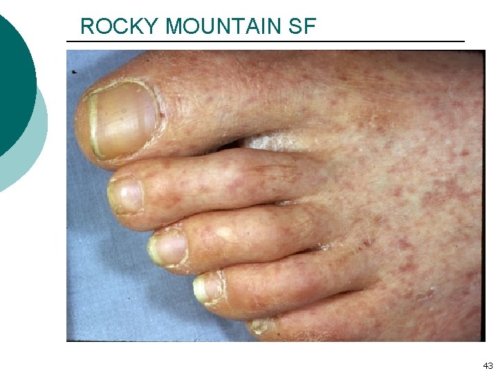 ROCKY MOUNTAIN SF 43 