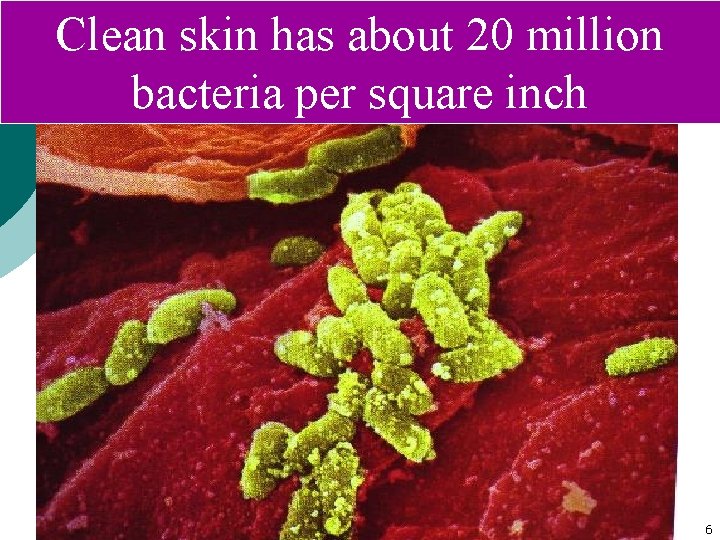 Clean skin has about 20 million bacteria per square inch 6 