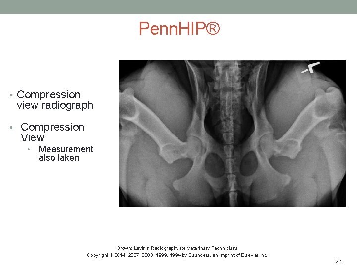 Penn. HIP® • Compression view radiograph • Compression View • Measurement also taken Brown:
