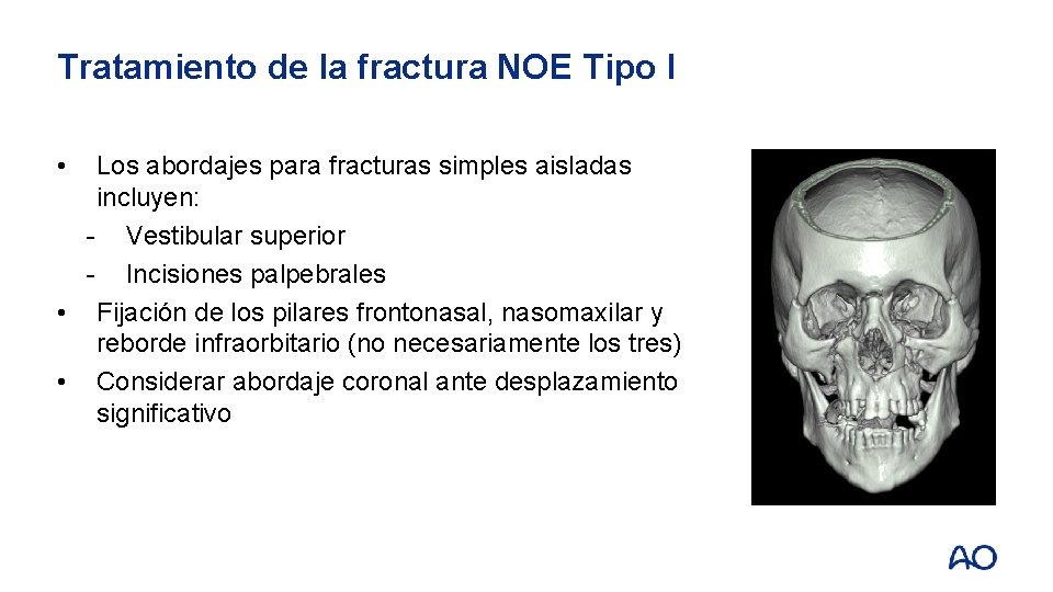 Tratamiento de la fractura NOE Tipo I • Los abordajes para fracturas simples aisladas