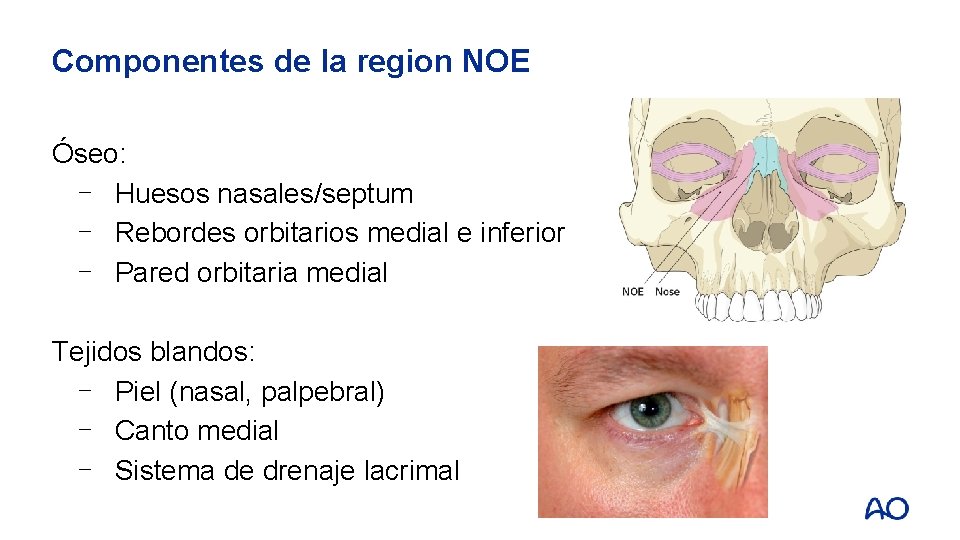 Componentes de la region NOE Óseo: ⎻ Huesos nasales/septum ⎻ Rebordes orbitarios medial e