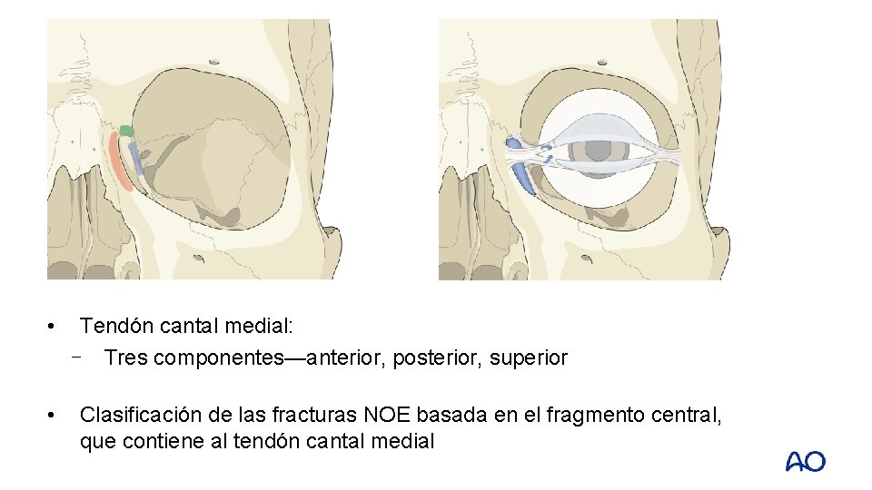  • • Tendón cantal medial: ⎻ Tres componentes—anterior, posterior, superior Clasificación de las
