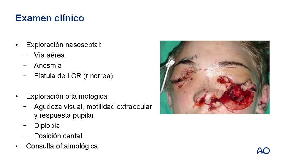 Examen clínico • • Exploración nasoseptal: ⎻ Vía aérea ⎻ Anosmia ⎻ Fístula de