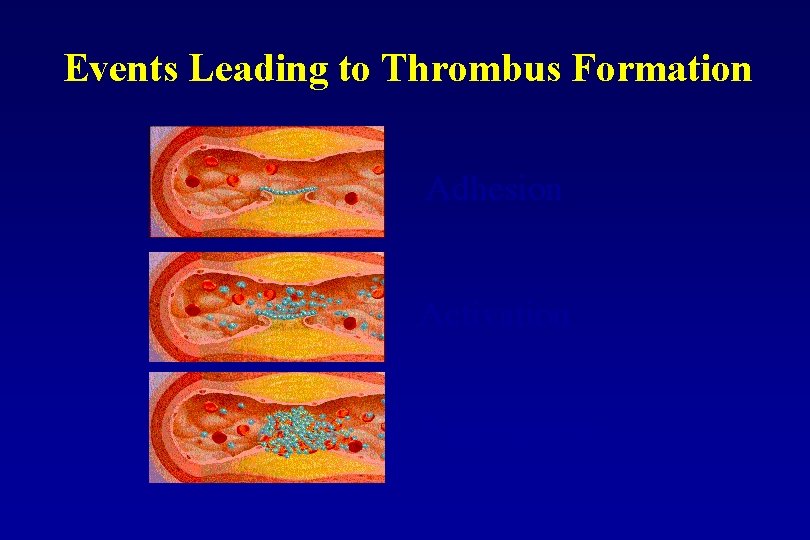 Events Leading to Thrombus Formation Adhesion Activation Aggregation 