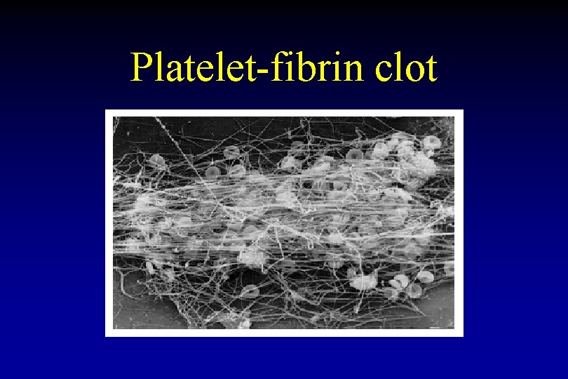 Platelet-fibrin clot 
