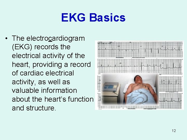 EKG Basics • The electrocardiogram (EKG) records the electrical activity of the heart, providing