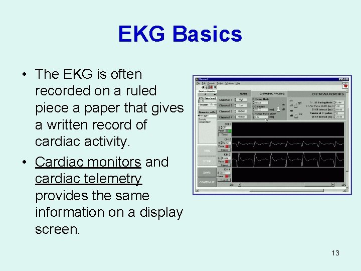 EKG Basics • The EKG is often recorded on a ruled piece a paper