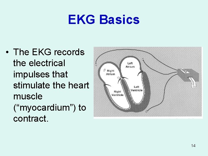 EKG Basics • The EKG records the electrical impulses that stimulate the heart muscle