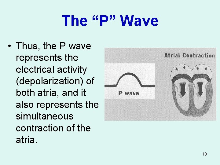 The “P” Wave • Thus, the P wave represents the electrical activity (depolarization) of