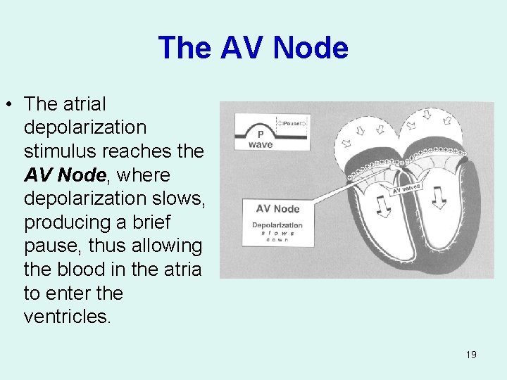 The AV Node • The atrial depolarization stimulus reaches the AV Node, where depolarization
