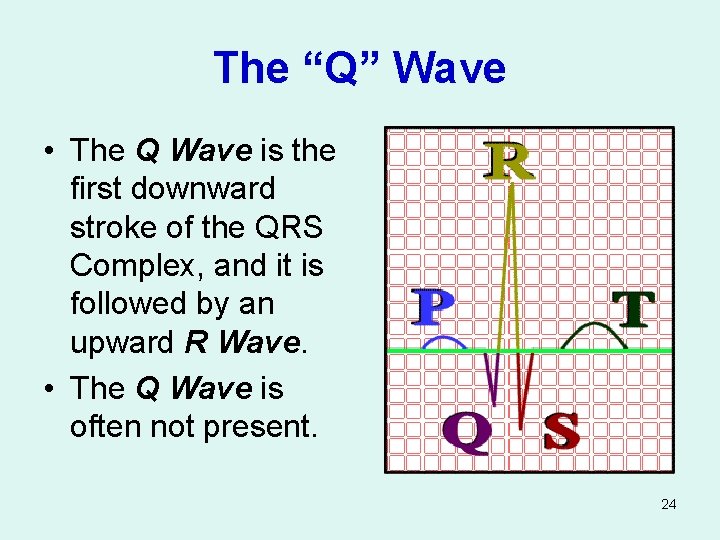 The “Q” Wave • The Q Wave is the first downward stroke of the