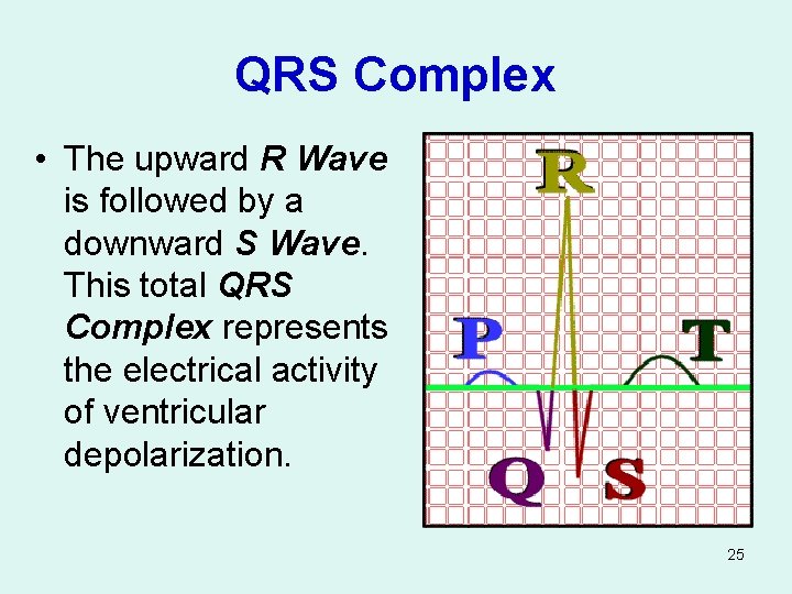 QRS Complex • The upward R Wave is followed by a downward S Wave.