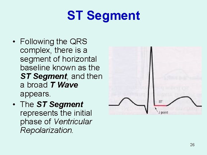 ST Segment • Following the QRS complex, there is a segment of horizontal baseline