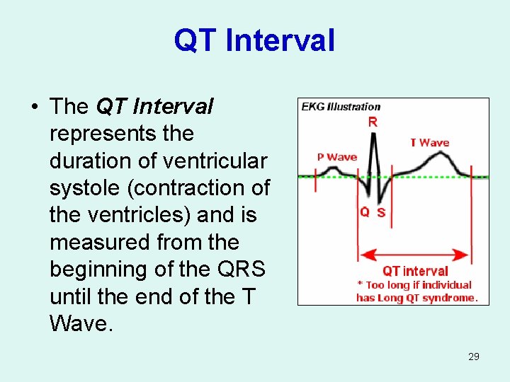 QT Interval • The QT Interval represents the duration of ventricular systole (contraction of