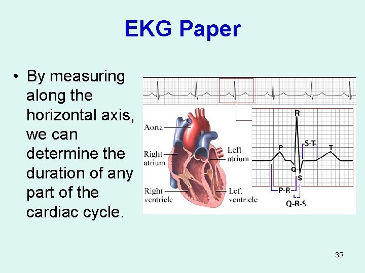 EKG Paper • By measuring along the horizontal axis, we can determine the duration