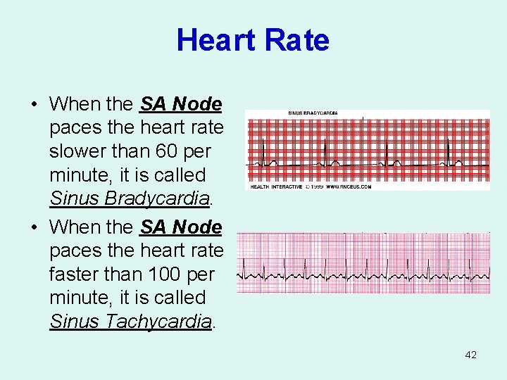 Heart Rate • When the SA Node paces the heart rate slower than 60