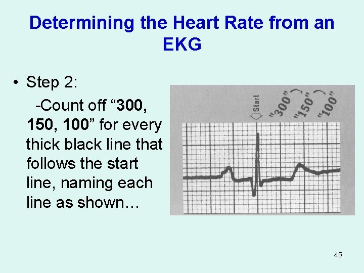 Determining the Heart Rate from an EKG • Step 2: -Count off “ 300,