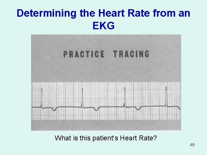 Determining the Heart Rate from an EKG What is this patient’s Heart Rate? 48