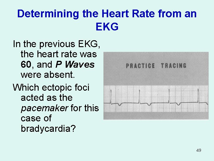 Determining the Heart Rate from an EKG In the previous EKG, the heart rate