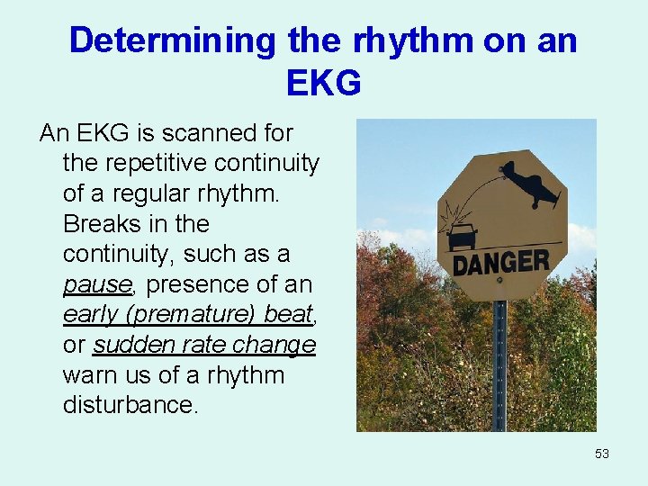 Determining the rhythm on an EKG An EKG is scanned for the repetitive continuity