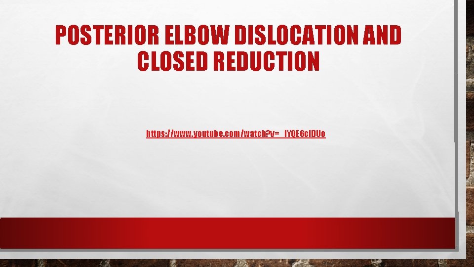 POSTERIOR ELBOW DISLOCATION AND CLOSED REDUCTION https: //www. youtube. com/watch? v=_l. YQE 6 c.