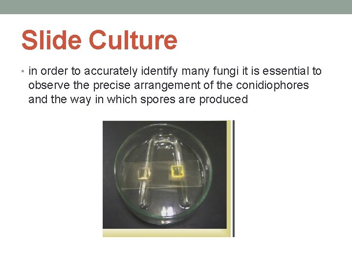 Slide Culture • in order to accurately identify many fungi it is essential to