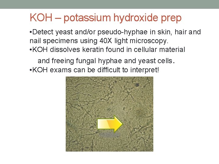 KOH – potassium hydroxide prep • Detect yeast and/or pseudo-hyphae in skin, hair and