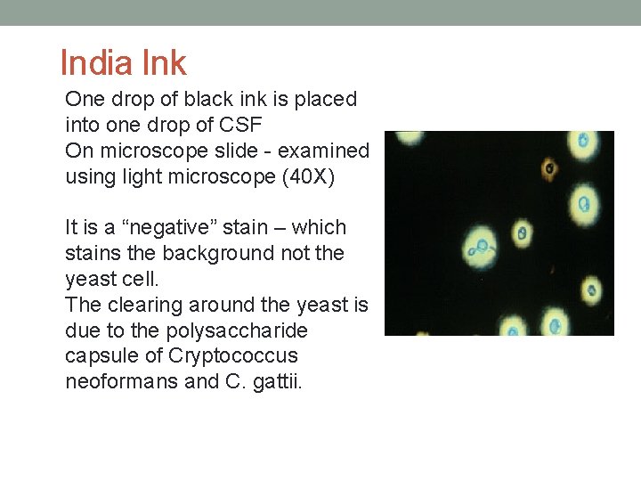 India Ink One drop of black ink is placed into one drop of CSF