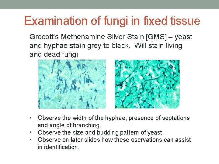 Examination of fungi in fixed tissue Grocott’s Methenamine Silver Stain [GMS] – yeast and