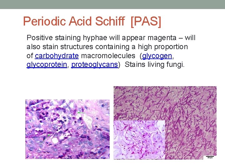 Periodic Acid Schiff [PAS] Positive staining hyphae will appear magenta – will also stain