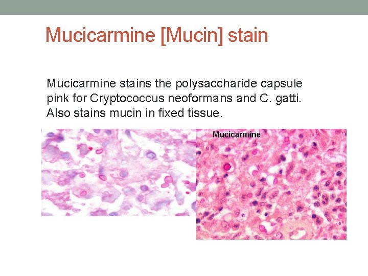 Mucicarmine [Mucin] stain Mucicarmine stains the polysaccharide capsule pink for Cryptococcus neoformans and C.