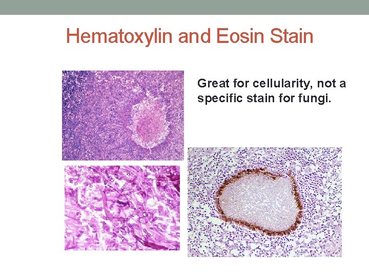 Hematoxylin and Eosin Stain Great for cellularity, not a specific stain for fungi. 