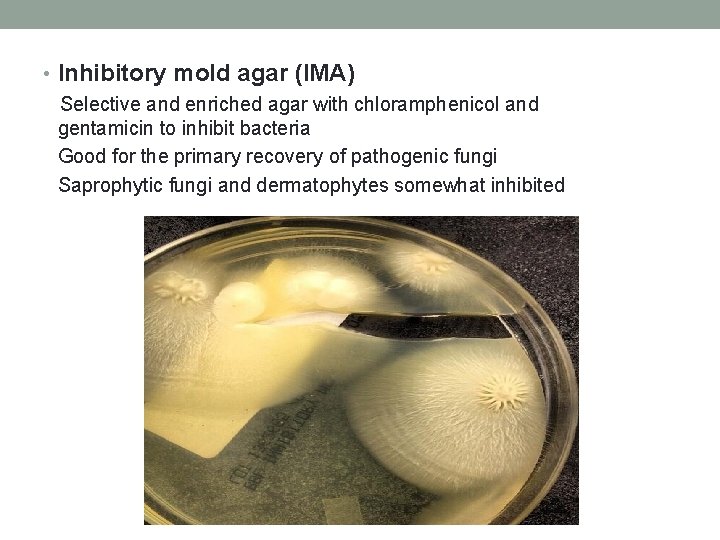  • Inhibitory mold agar (IMA) Selective and enriched agar with chloramphenicol and gentamicin