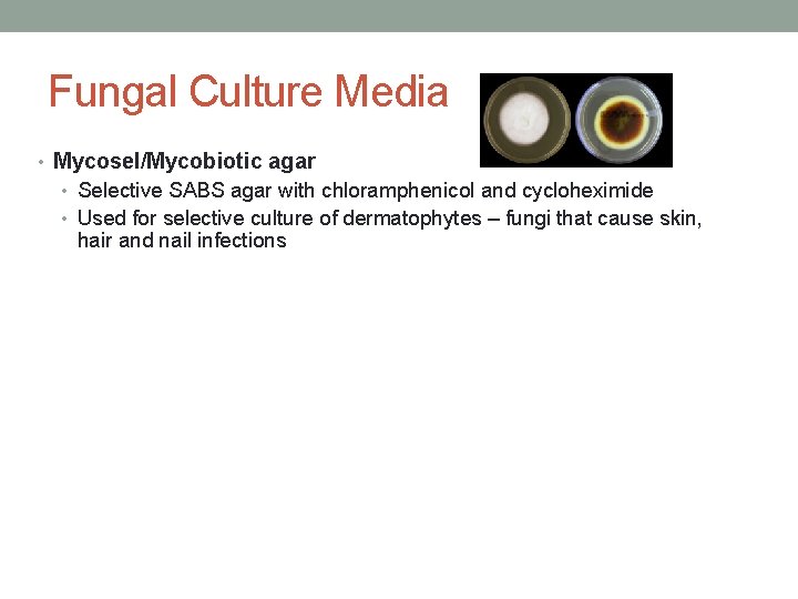Fungal Culture Media • Mycosel/Mycobiotic agar • Selective SABS agar with chloramphenicol and cycloheximide