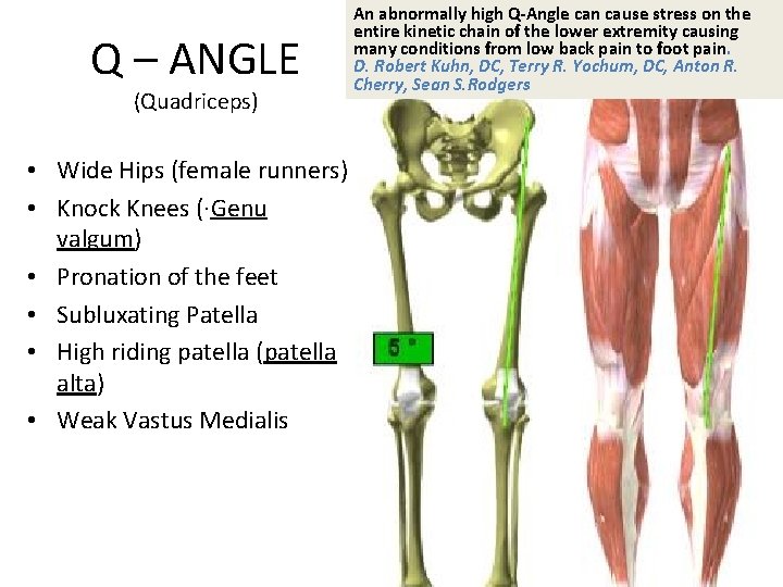 Q – ANGLE (Quadriceps) • Wide Hips (female runners) • Knock Knees (·Genu valgum)