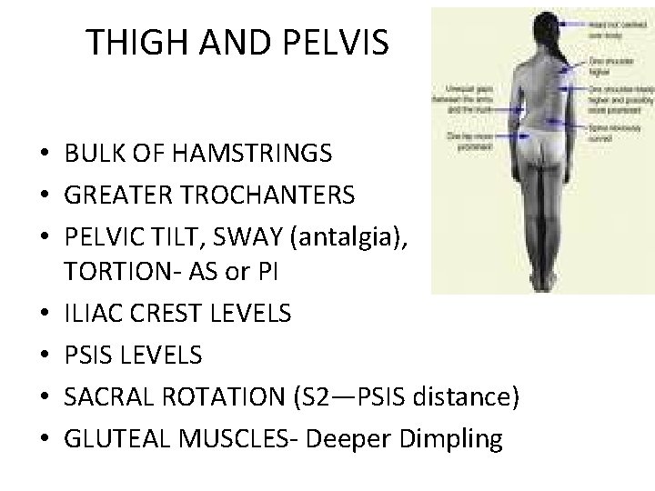 THIGH AND PELVIS • BULK OF HAMSTRINGS • GREATER TROCHANTERS • PELVIC TILT, SWAY