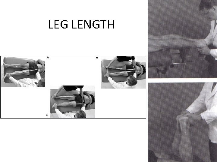 LEG LENGTH 