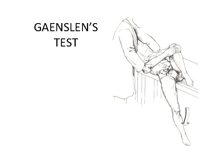 GAENSLEN’S TEST 