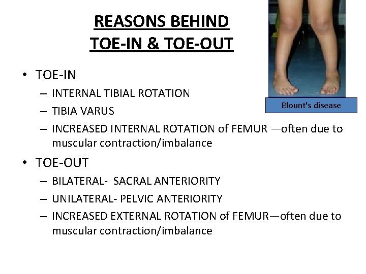 REASONS BEHIND TOE-IN & TOE-OUT • TOE-IN – INTERNAL TIBIAL ROTATION Blount's disease –